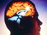 Разработана методика чтения мыслей методом сканирования мозга